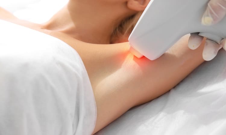 Laser-Hair-Removal-Vancouver