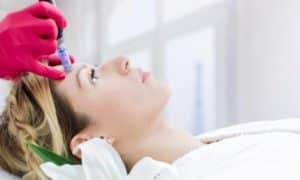 Vancouver Microneedling