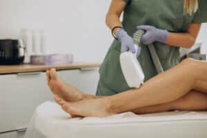 laser hair removal process