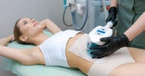 Woman receiving a non-invasive fat freezing treatment on the abdomen using a cooling device