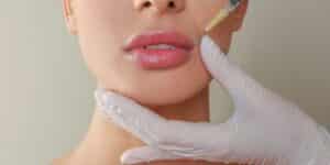 Close-up of a person receiving a lip filler injection with a syringe while a practitioner wearing white gloves supports the chin and lower face.
