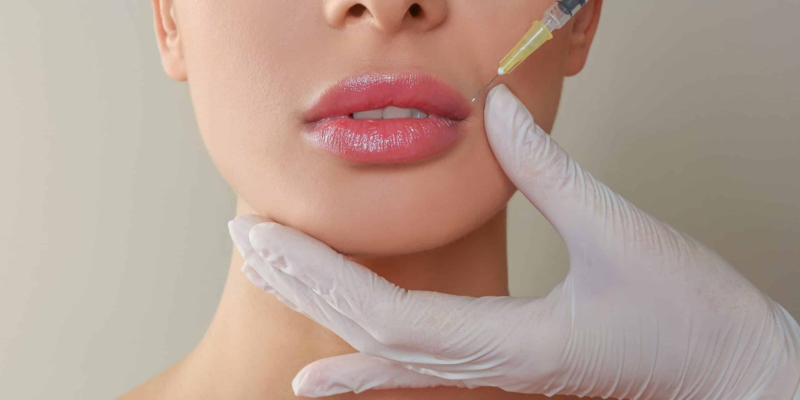 Close-up of a person receiving a lip filler injection with a syringe while a practitioner wearing white gloves supports the chin and lower face.