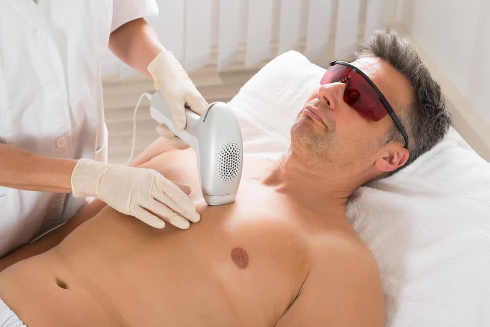 Person receiving laser hair removal treatment on the chest before a vacation to achieve smooth, long-lasting hair reduction with minimal maintenance.