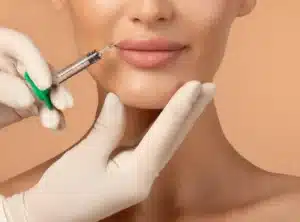 Lip filler treatment being administered with an injection near the lips